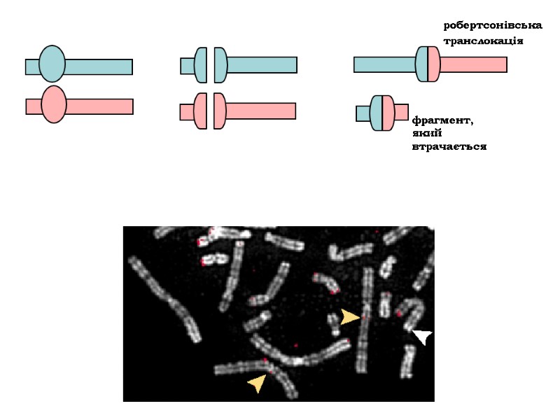 робертсонівська  транслокація фрагмент,  який  втрачається
